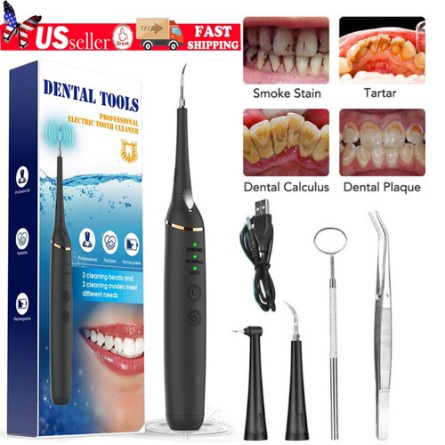Ultrasonic electric tooth - ultrasonic,