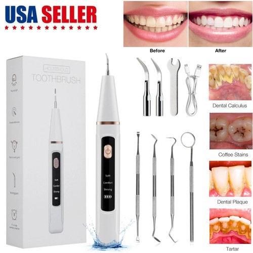 Ultrasonic electric tooth - ultrasonic,