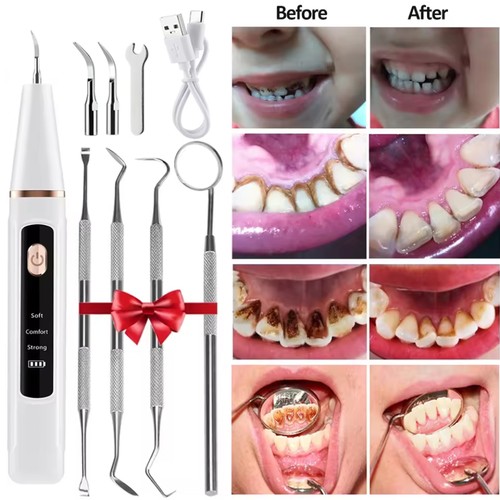 Ultrasonic electric tooth - electric,