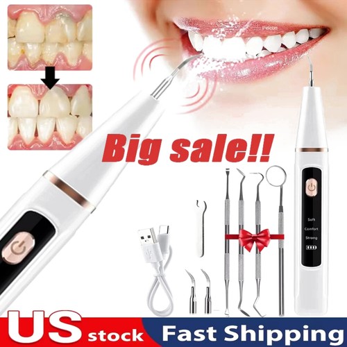 Ultrasonic electric tooth - ultrasonic,