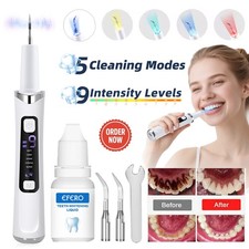 Electric Ultrasonic Tooth