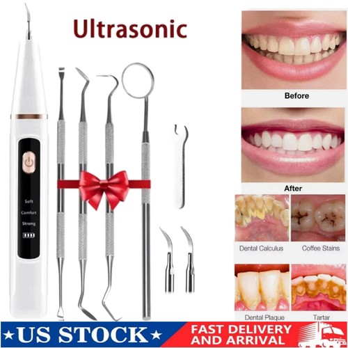Ultrasonic electric tooth - ultrasonic,