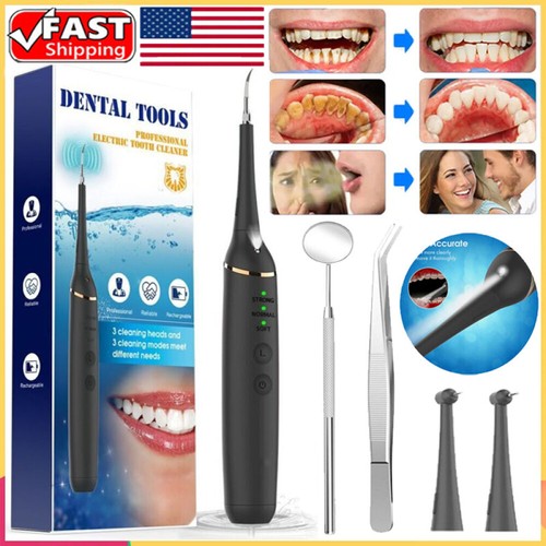 Ultrasonic tooth cleaner kit - cleaner,