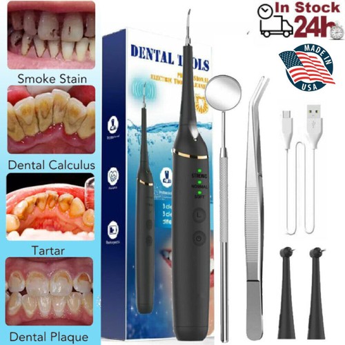 Electric ultrasonic tooth - electric,