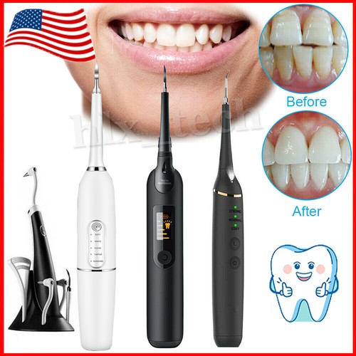 Ultrasonic tooth cleaner - ultrasonic,